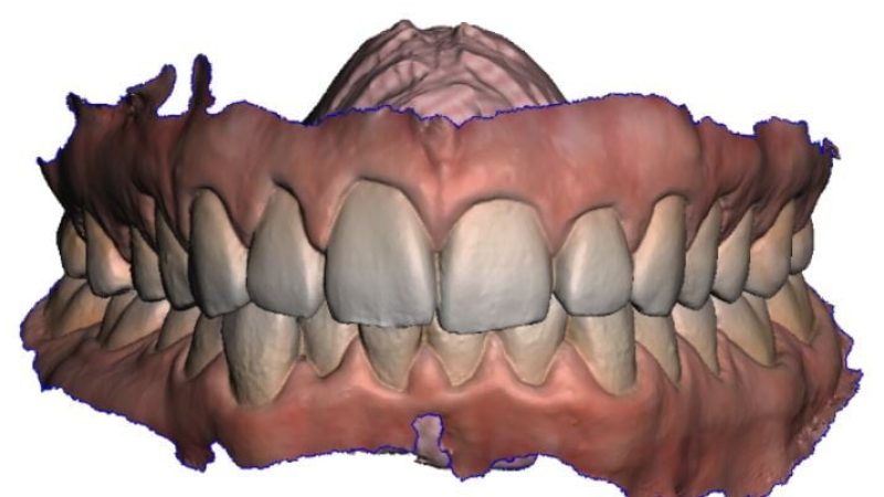Cirugía guiada y asistida por ordenador