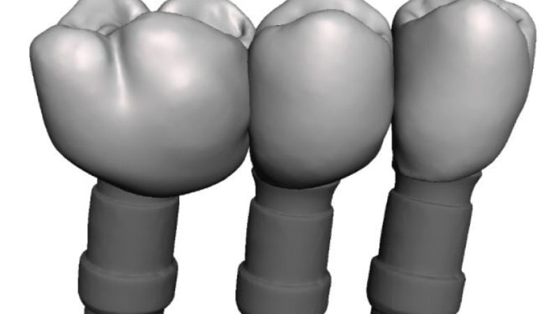 Cirugía guiada y asistida por ordenador3